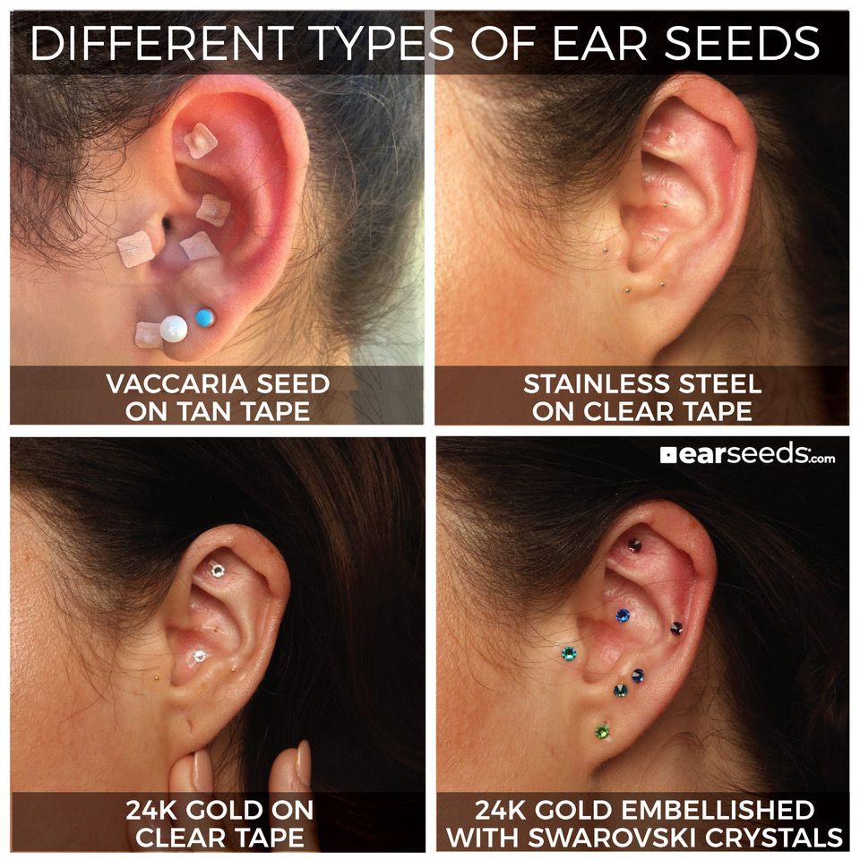 Different types of ear seeds: (top left) vaccaria seed on tan tape, (top right) stainless steel on clear tape, (bottom left) 24K gold clear tape, (bottom right) 24K gold embellished with Swarovski crystals